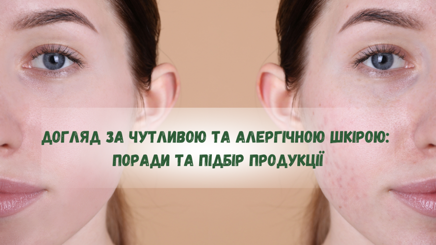 Догляд за чутливою та алергічною шкірою: Поради та підбір продукції