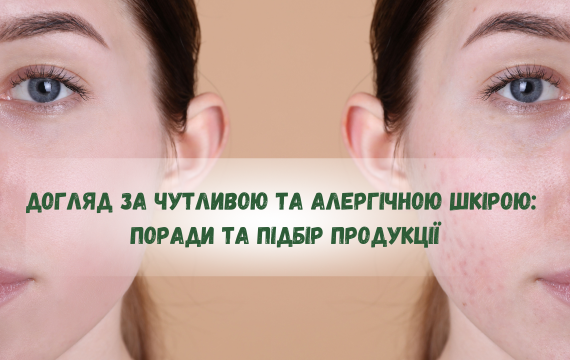 Уход за чувствительной и аллергичной кожей: советы и подбор средств Уход за чувствительной и аллергичной кожей: советы и подбор средств