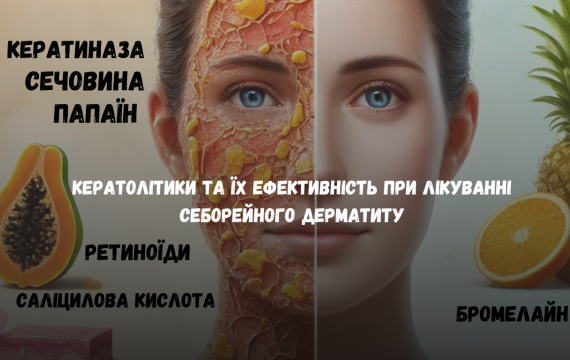Кератолітики та їх ефективність при лікуванні себорейного дерматиту Кератолітики та їх ефективність при лікуванні себорейного дерматиту