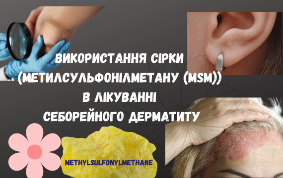 Применение серы (метилсульфонилметана (MSM)) в терапии себорейного дерматита Применение серы (метилсульфонилметана (MSM)) в терапии себорейного дерматита